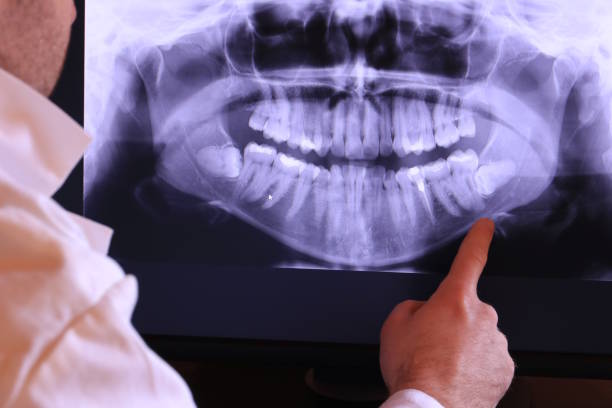 Best Emergency Root Canal Treatment in Demorest, GA