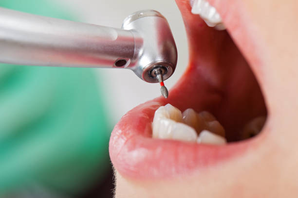 Best Walk-In Emergency Dentist in Demorest, GA